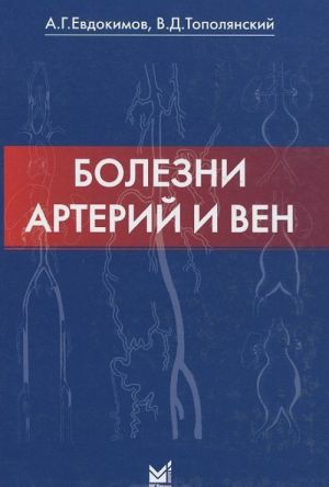 Болезни артерий и вен