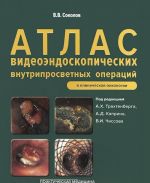 Атлас видеоэндоскопических внутрипросветных операций в клинической онкологии