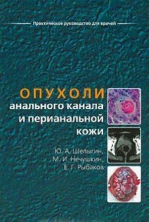 Опухоли анального канала и перианальной кожи