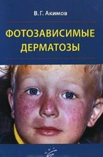 Fotozavisimye dermatozy