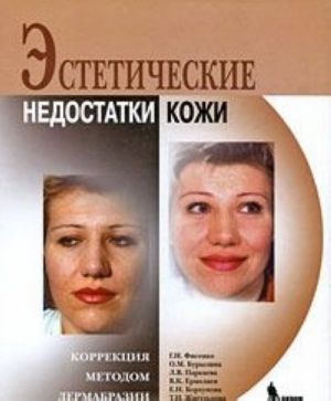 Esteticheskie nedostatki kozhi. Korrektsija metodom dermabrazii