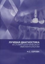 Luchevaja diagnostika v stomatologicheskoj implantologii