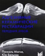 Адгезивные керамические реставрации передних зубов