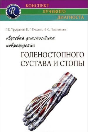 Лучевая диагностика повреждений голеностопного сустава и стопы