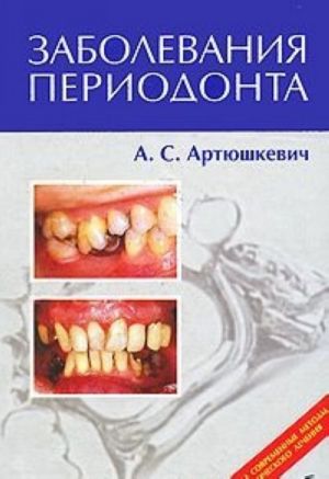 Zabolevanija periodonta