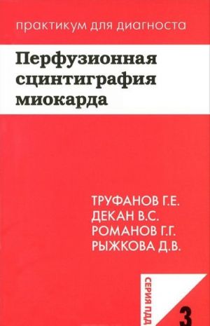 Перфузионная сцинтиграфия миокарда