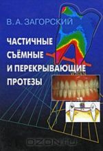 Chastichnye semnye i perekryvajuschie protezy