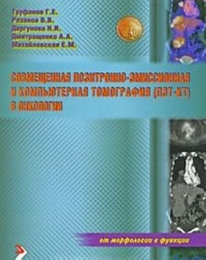 Совмещенная позитронно-эмиссионная и компьютерная томография (ПЭТ-КТ) в онкологии