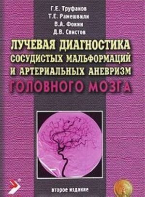 Лучевая диагностика сосудистых мальформаций и артериальных аневризм головного мозга