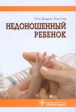 Недоношенный ребенок. Если ребенок родился раньше срока