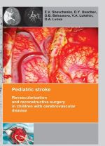 Pediatric stroke