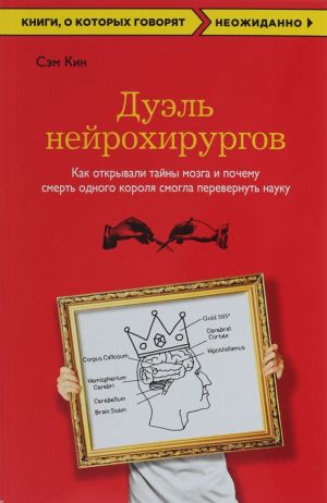 Дуэль нейрохирургов. Как открывали тайны мозга, и почему смерть одного короля смогла перевернуть науку