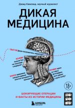 Dikaja meditsina. Shokirujuschie operatsii i fakty iz istorii meditsiny