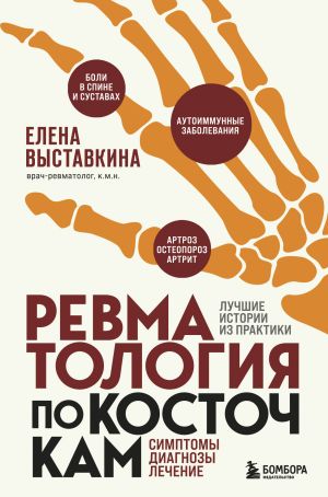 Revmatologija po kostochkam. Simptomy, diagnozy, lechenie