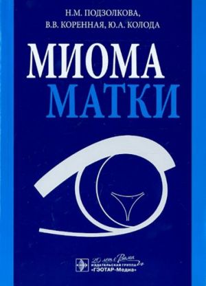 Mioma matki