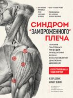 Синдром "замороженного" плеча. Терапия триггерных точек для преодоления боли и восстановления диапазона движений