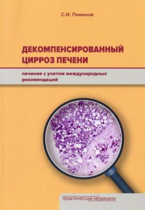 Dekompensirovannyj tsirroz pecheni. Lechenie s uchetom mezhdunarodnykh rekomendatsij